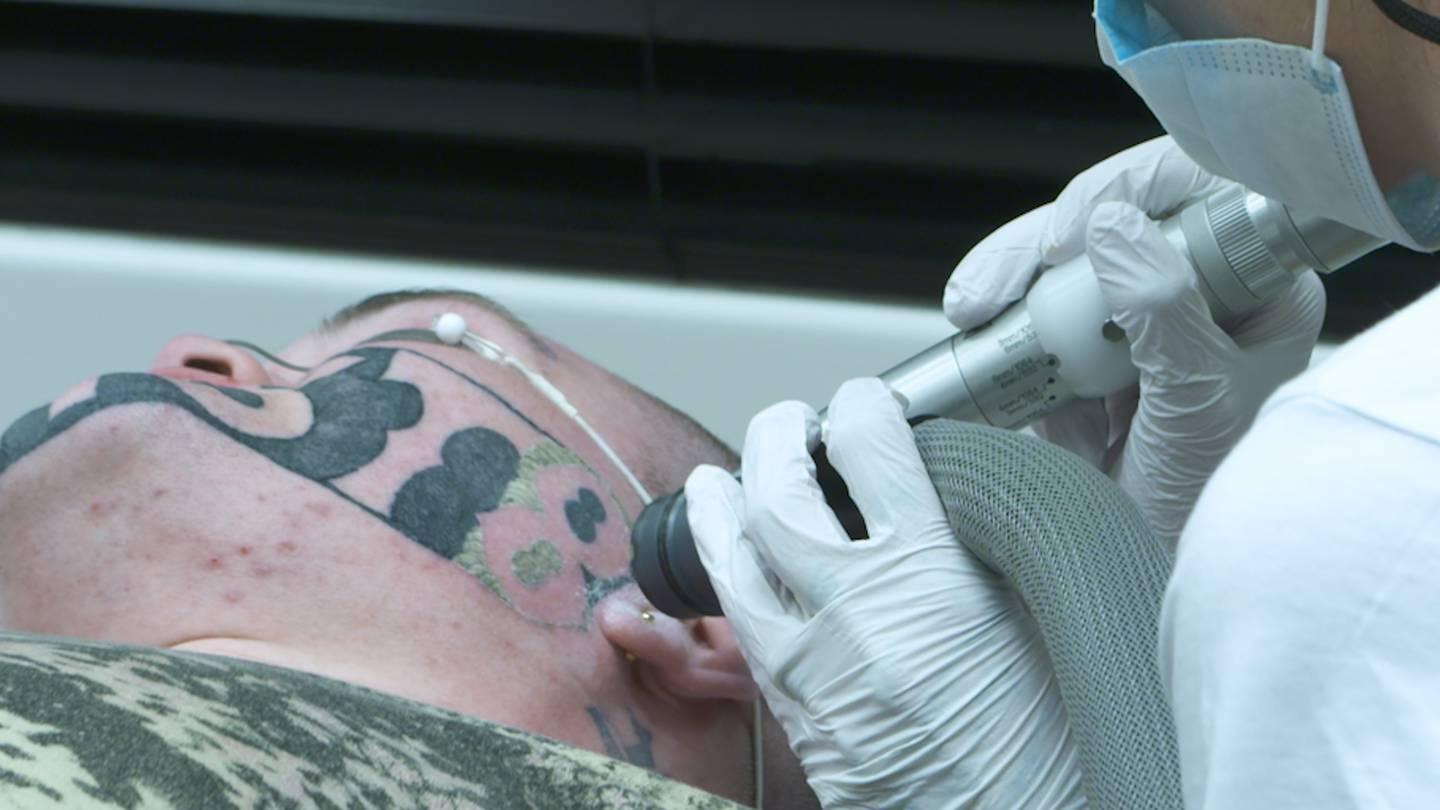 Online Tattoo Removal Course | Skinart New Zealand